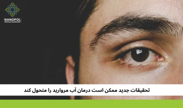 تحقیقات جدید ممکن است درمان آب مروارید را متحول کند