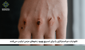 نانوذرات دو استراتژی را برای تسریع بهبود زخمهای مزمن ترکیب میکنند